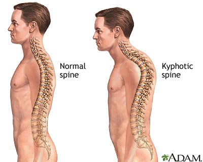 thoracic spine mobility posture