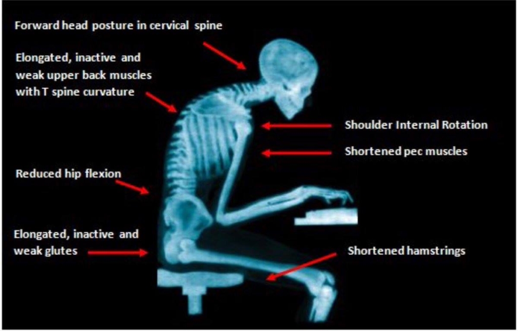 surfstrengthcoach-cómo-mejorar-el-escritorio-dorsal